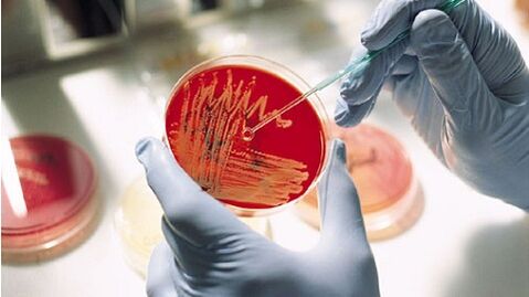 cultura bacteriana pentru prostatita pentru a prescrie antibiotice